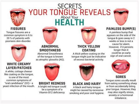 Tongue Coating