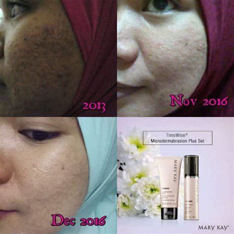 Back to products skincare collection timewise. Mary Kay TimeWise Microdermabrasion Set Testimoni dan Review