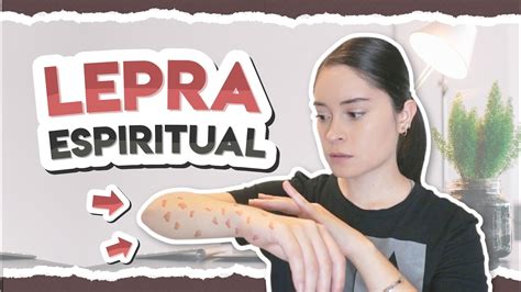 ¿tienes Lepra Espiritual Youtube