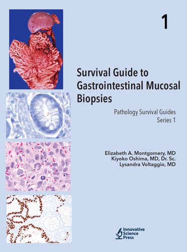 Survival Guide To Gi Mucosal Biopsies Innovative Pathology