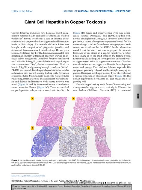 Pdf Giant Cell Hepatitis In Copper Toxicosis