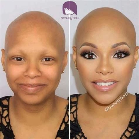 Pin By Tameika On Be You Love You With Images Alopecia Awareness