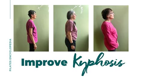 How To Improve Kyphosis With Pilates It May Surprise You