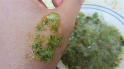 Vitamin c can help kill bacteria and rebuild skin collagen. Coriander Face Mask for Pimple Scar Removal - DIY