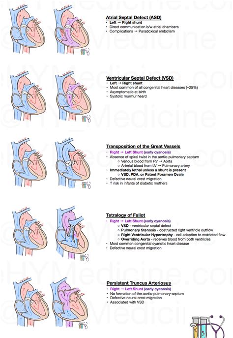 Congenital Heart Defects Pediatric Heart Pediatric Heart Defects