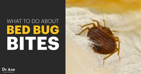 Dealing with bed bug bites? Bed Bug Bites: Symptoms, Facts & Natural Treatments - Dr. Axe