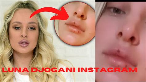 Why Luna Djogani Has Sores On Her Mouth Luna Djogani Instagram Youtube