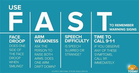 Even if all the symptoms resolve, it is very. Under 45? You probably don't know the signs of stroke ...