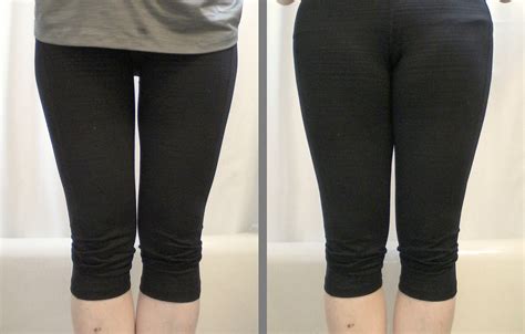 The Body Image Project Thigh Gap Depthdepth
