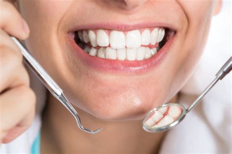 General Dentistry White Fillings — Kingsway Dental Practice