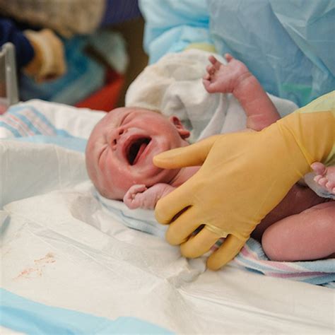 Newborn Circumcision The Healing Process