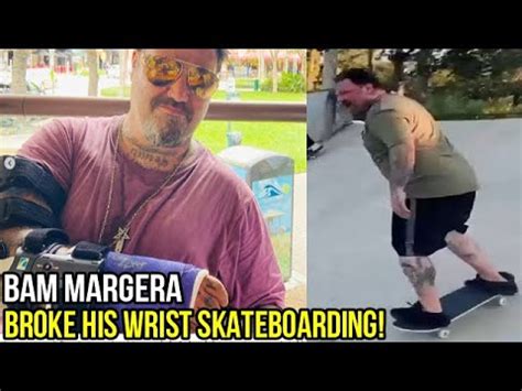 Bam Margera Broke His Wrist Skateboarding Youtube