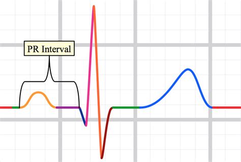 Teaching Medicine Tutorial Analyze The Waveforms