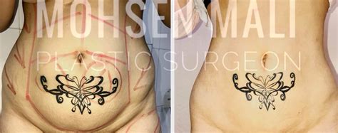 إنها عملية تجري على مستوى العالم أجمع، سوف تتحول فيها الملكية من المدين إلى الدائن، ويجري من خلالها تحول هائل في تركيز الملكية إلى أيدي عدد من البنوك العالمية، التي تتحكم في الاحتياطي الفدرالي الأمريكي. شفط دهون البطن و الفخذين وشفط دهون الارداف و شفط دهون ...