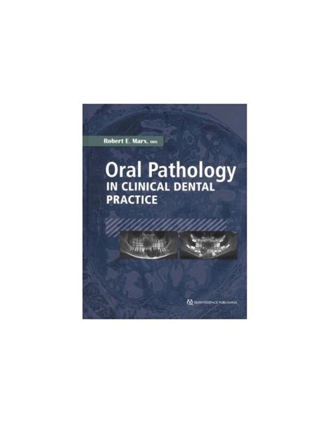 Oral Pathology In Clinical Dental Practice