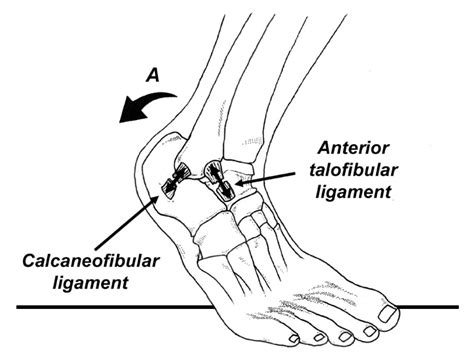 How To Rehab A Sprained Ankle Human Locomotion
