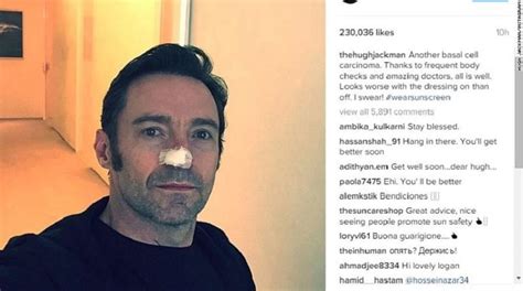 Hugh Jackman Reveals Another Skin Cancer Treatment Loop Png