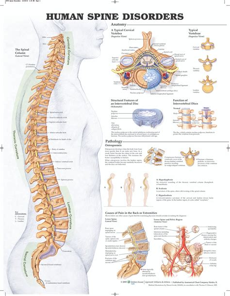 Reference Chart Human Spine Disorders
