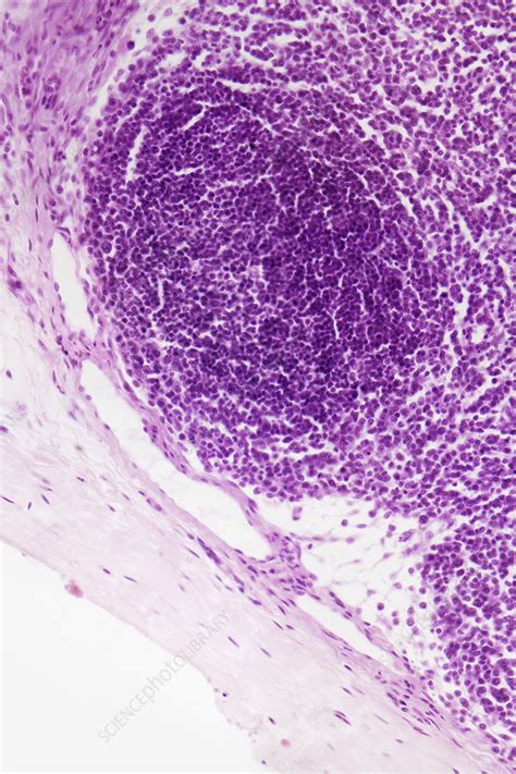 Lymph Gland Section Stock Image C0126336 Science Photo Library