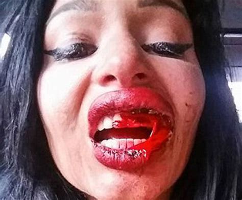 Beauty And The Beast Glamour Model Battered While Holding