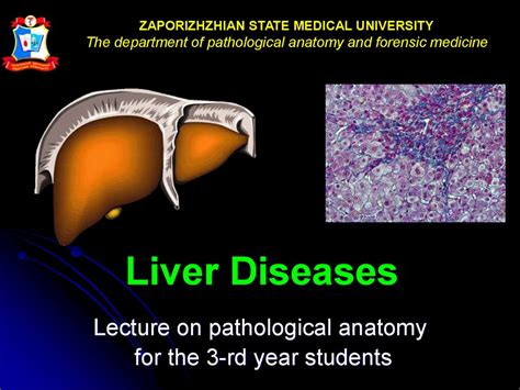 Liver Diseases презентация онлайн