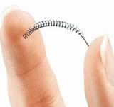 Photos of What Are The Side Effects Of The Essure Procedure