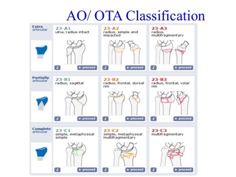 Ao Ota Fracture Classification Pdf Newmarket