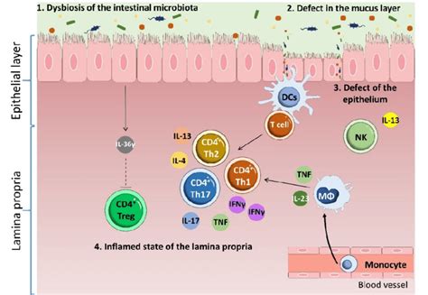 Pathophysiology Of Inflammatory Bowel Disease Multiple Factors Download Scientific Diagram
