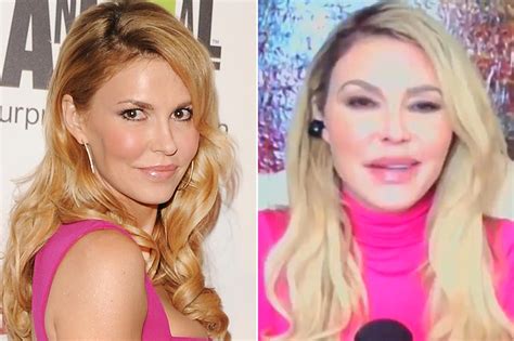 Did Brandi Glanville Have A Plastic Surgery What Happened To Her Face