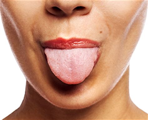 What Your Tongue Can Tell You - Nicollet Station Dental