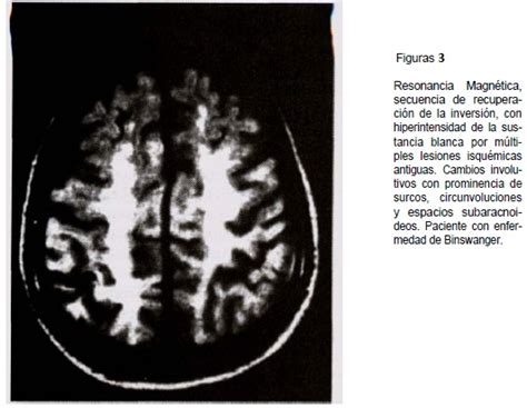 We did not find results for: NEUROIMAGENES EN LA EVALUACIÓN DE LAS DEMENCIAS