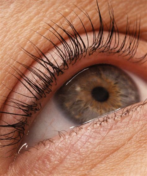 Ingrowing Eyelashes Optimum Vision Clinic