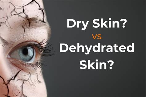Dehydrated Skin Vs Dry Skin Whats The Difference Sibu Seaberry