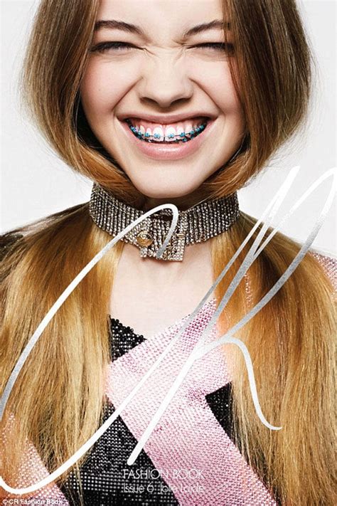 Braces Become Springs Newest Trend As Fashion Industry Casts Models