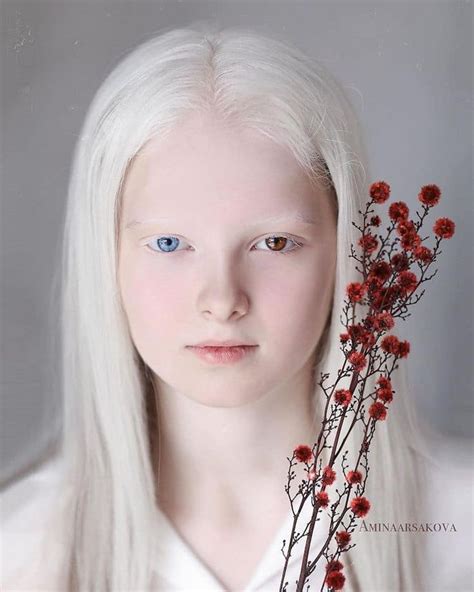 Ethereal Portraits Highlight The Unique Beauty Of A Girl With Albinism