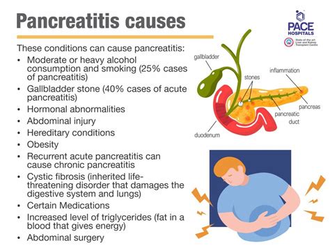 Causas Principales De La Mortal Pancreatitis Hot Sex Picture