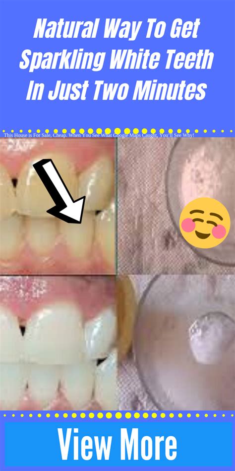 Natural Way To Get Sparkling White Teeth In Just Two Minutes White