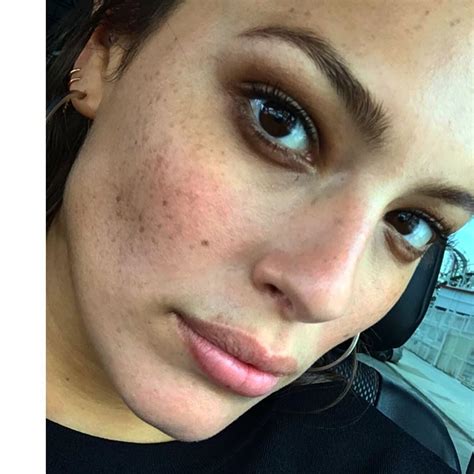 20 Celebrities You Didnt Know Had Freckles Sheknows