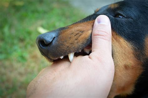 Immediate Steps To Take After A Dog Bite