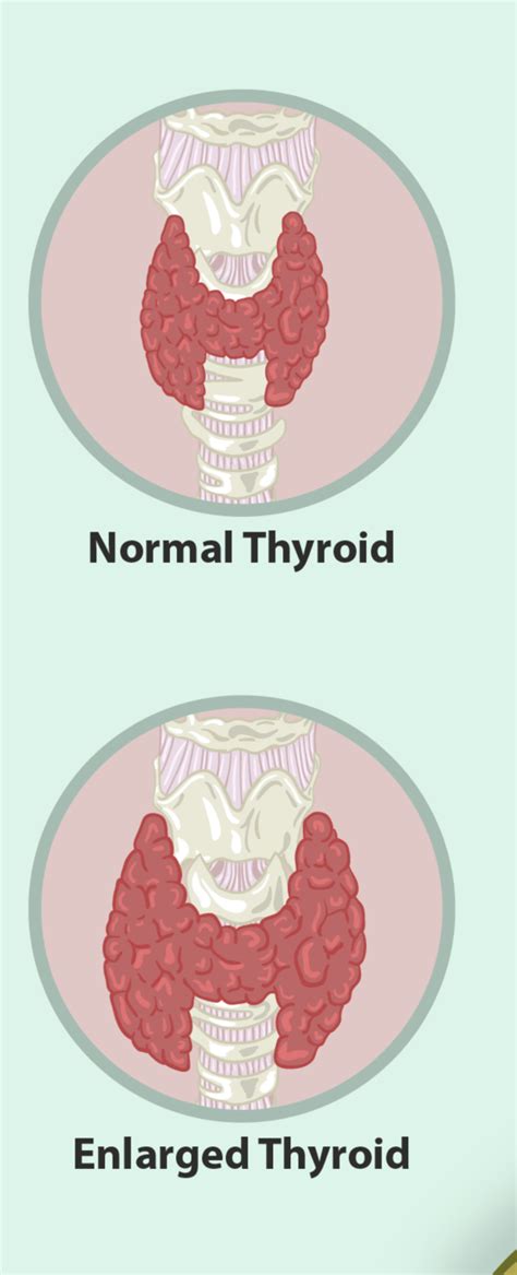 95 Thyroid Gland Human Biology