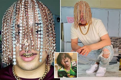 Rapper Dan Sur Gets Gold Chain Implanted Into His Head — Guardian Life