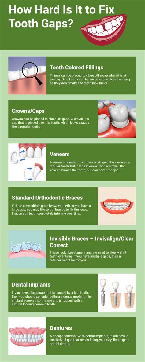How to close a gap in your teeth at home in hindi. How Cosmetic Dentistry Can Help You Fix Your Gapped Teeth ...