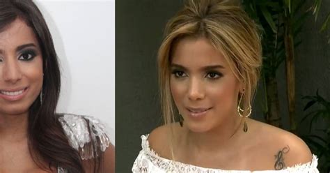 Anitta Antes E Depois Da Fama Mudança