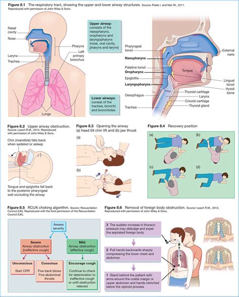 Airway Diagram Emt