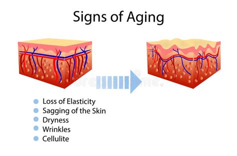 Skin Aging Diagrams Young Skin Is Firm Tight Its Collagen Vector