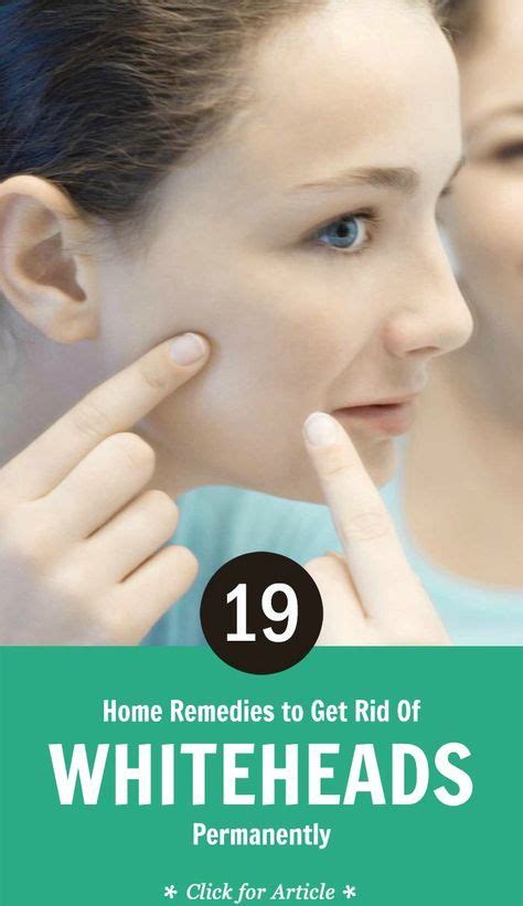 How To Get Rid Of Whiteheads Naturally At Home Whiteheads How To