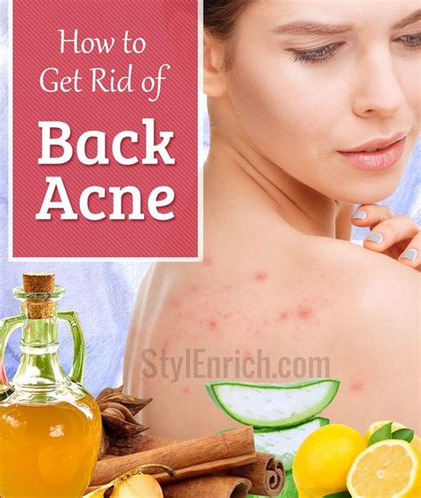 How To Get Rid Of Back Acne How To Get Rid Of Acne Back Acne