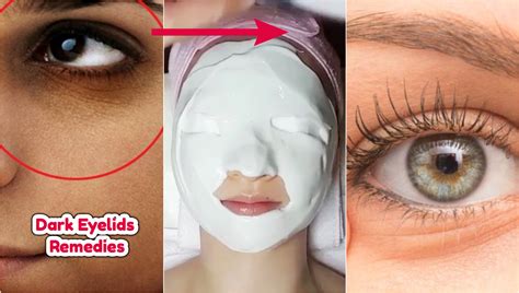 How To Get Rid Of Dark Spots On Eyelids