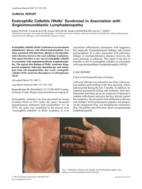 Pdf Eosinophilic Cellulitis Wells Syndrome In Association With
