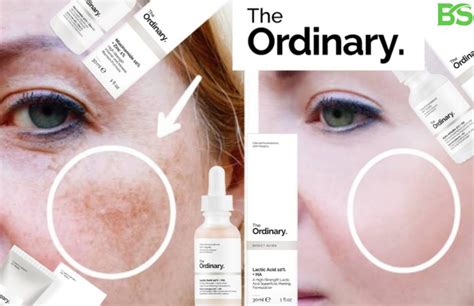 Best The Ordinary Products For Hyperpigmentation Skincare Routine